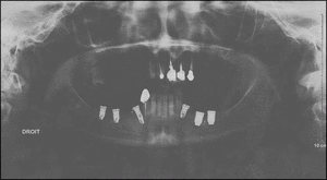 Pano rqwbkv - Eugenol