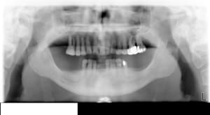 Pano uhlq6y - Eugenol