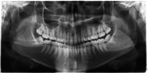 Pano wbexir - Eugenol