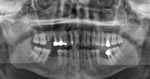 Pano zsm8k0 - Eugenol