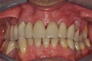 Parodo 1 gqzipt - Eugenol