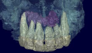 Patricia 3d kyste2 bfz9ob - Eugenol