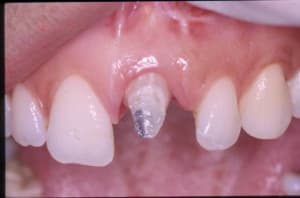 Pendant xb3loq - Eugenol