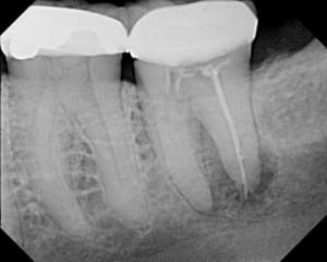 Pennwell.web.400 - Eugenol
