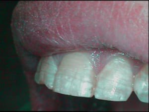 Pere hw7tpw - Eugenol