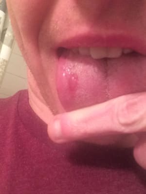 Pewz6qlhep1ymqokm22t - Eugenol