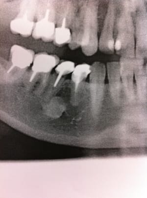 Photo1 xxlxko - Eugenol
