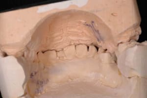 Photo7 gjfndo - Eugenol