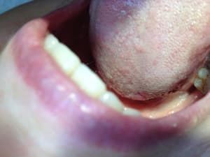 Photo 1 vtsnxw - Eugenol