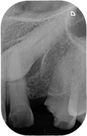 Photo 3 zxcskg - Eugenol
