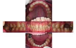 Photos de face ypkgkb - Eugenol