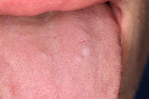 Pic2 rdmmlr - Eugenol
