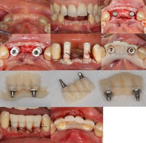 Planche 2 wp6d2g - Eugenol