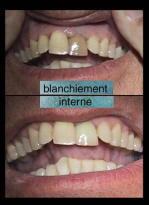 Planche av ap....web. - Eugenol
