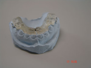 Plaque isaie 3 nxmu7h - Eugenol