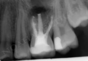Post op dd5zvh - Eugenol