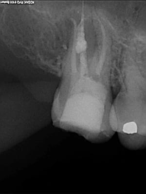 Post op rte mta 2007 j9n6jh - Eugenol