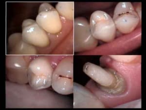 Pour gül 1 gxhtii - Eugenol