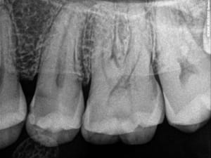 Premo zyecjf - Eugenol