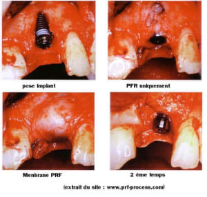 Prf rv6wge - Eugenol