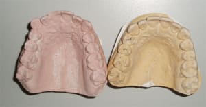 Prign augoov - Eugenol