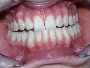 Propulsion rjadbw - Eugenol