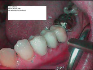 Prov okm6xv - Eugenol