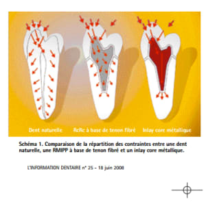 Répartition containte ciao3u - Eugenol