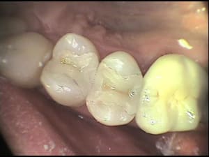 R1 ttbgpo - Eugenol