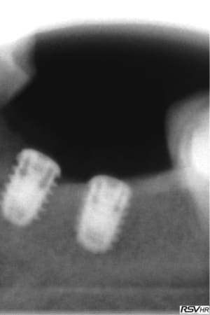 Rac2 nrwzfk - Eugenol