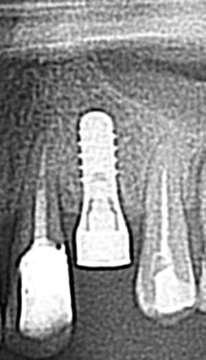 Radio post jby1pa - Eugenol