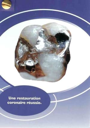 Rec2 vdr6rm - Eugenol