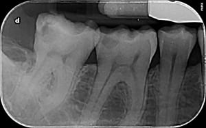 Roc 26620 37 qahwrz - Eugenol