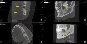 Scan3 iofgpq - Eugenol