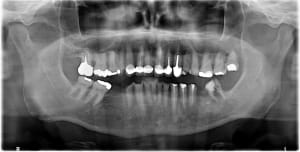 Se6y7gcuc2ffxssqrs7ht7693yz5 - Eugenol