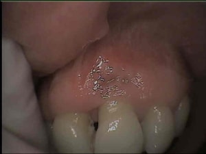 Sept2012 fxz4c9 - Eugenol