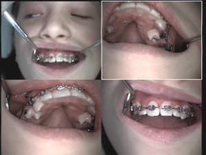 Sept mois et demi prgvmg - Eugenol
