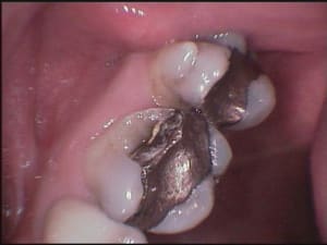Service rendu par un amg mcfosg - Eugenol