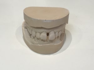Setwepfgir9o3wd26wdg - Eugenol