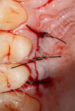 Site donneur tdiawl - Eugenol