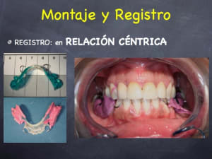 Slide - Eugenol
