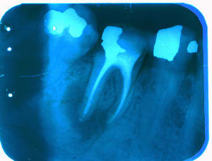 Sortons les rames  zmzice - Eugenol