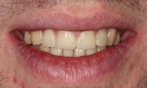 Sourir   6j h6wjet - Eugenol