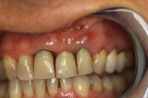 Sourire  1  ks0nsi - Eugenol