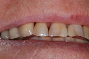 Sourire dqz88s - Eugenol