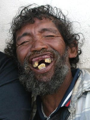 Sourire tk3tpy - Eugenol