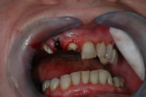 T1 rkzmig - Eugenol