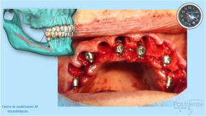 Tctretxtkx7chak15bjxdha6bg54 - Eugenol