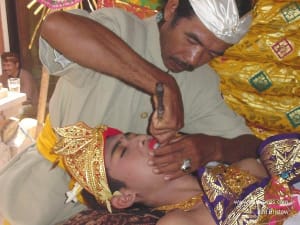 Teeth2 lw67y9 - Eugenol