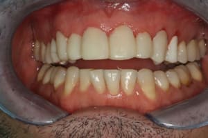 Tempo jzz3ll - Eugenol